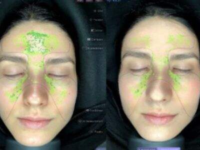 How accurate is skin analysis machine?