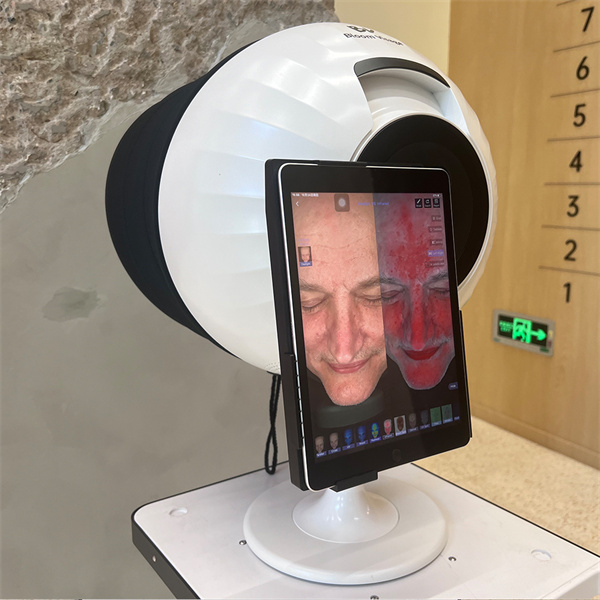 Digital Skin Analysis Machine for Clearer Skin