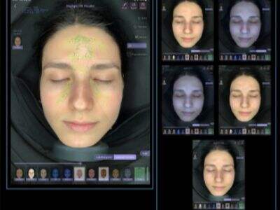 Intelligent Skin Analysis Machine Manufacturer From China