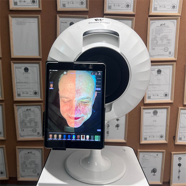 Откривање тајни ваше коже помоћу дигиталне анализе