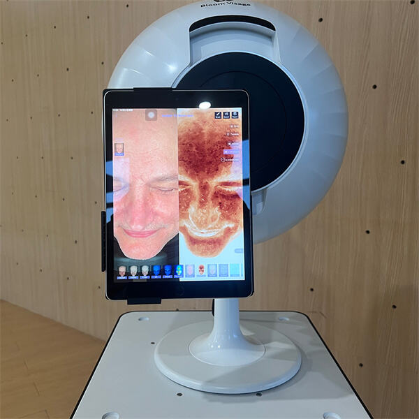 Напређена опрема за анализу коже за персонализоване планове лечења