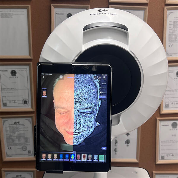 Анализирајте стање и потребе своје коже код куће