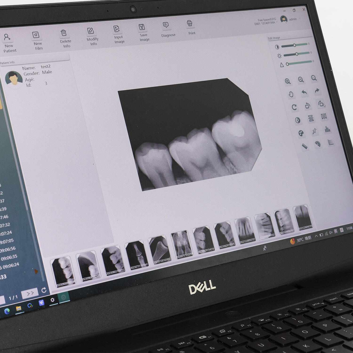 Jak skanery intraoralne zmieniają doświadczenie stomatologiczne