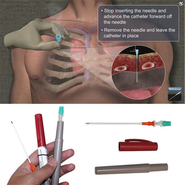 Don't Underestimate the Impact of Needle Size in Chest Decompression