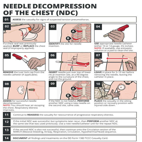 Angiocath Needle Decompression for Acute Respiratory Distress