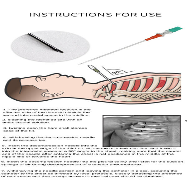 Angiocath Needle Decompression in Critical Care Settings