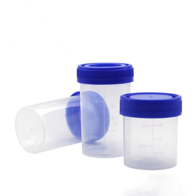 Why is a vacuum urine cup crucial for urine analysis?