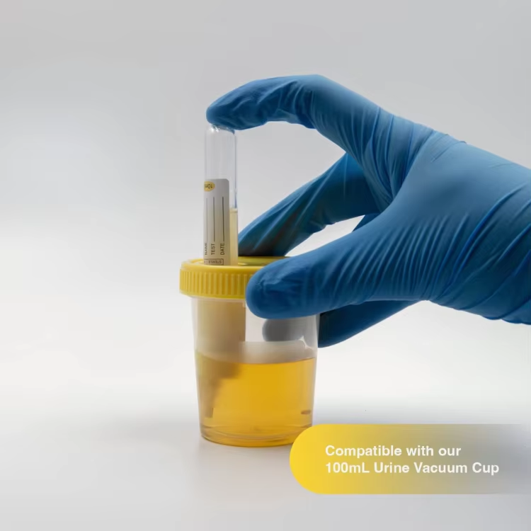 How to ensure the hygiene and safety of vacuum urine cups?
