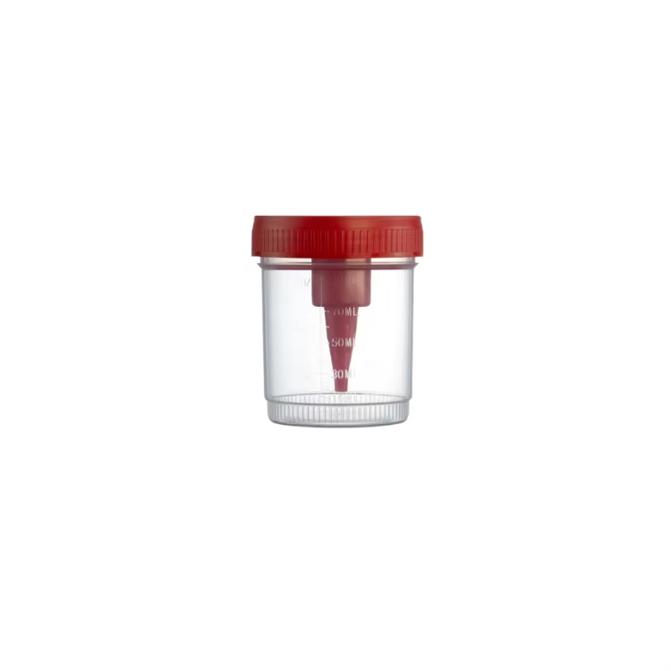 What are the environmental considerations for vacuum urine cups?