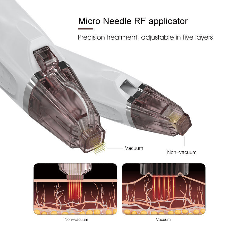 Vacuum Microneedling & Insulated Needles: What Really Makes the Difference?