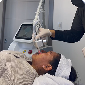 fractional co2 laser machine103-8