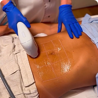 terminal age hlfu machine351-14