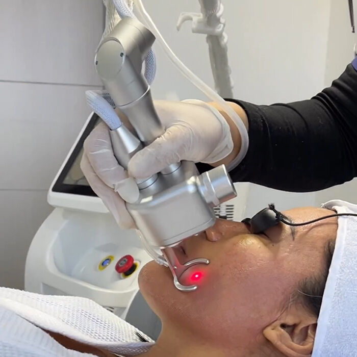 Fractional CO2 laser has excellent efficacy in the field of skin treatment and possesses two significant clinical