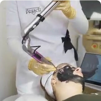 q switch nd yag laser615-7