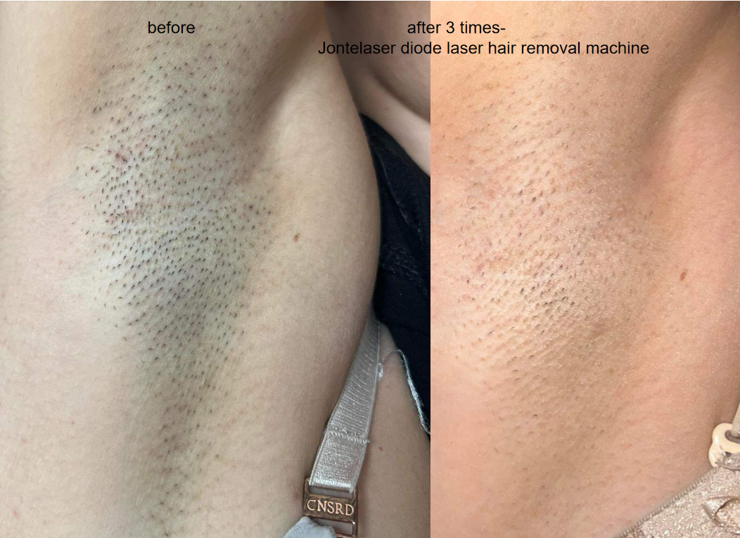 Revolucionarna tehnologija s dvije valove