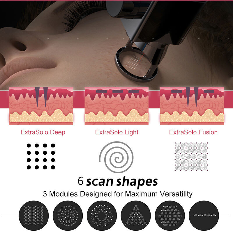 Advanced Fractional Technology Delivers Superior Results