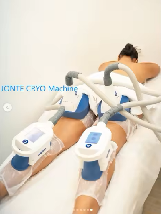 Clinical Advantages of 360° Cryolipolysis Applicator