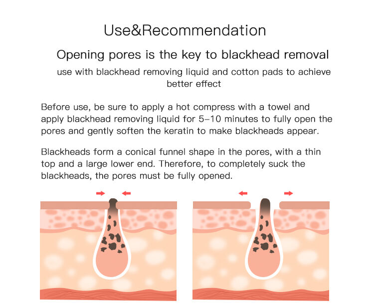 Vacuum Blackhead Remover details