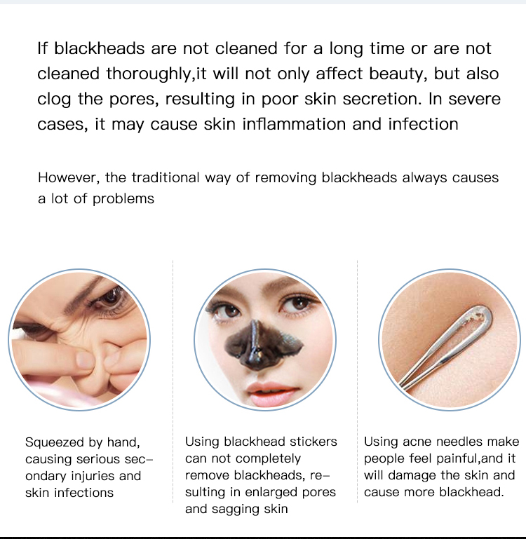 Vacuum Blackhead Remover factory