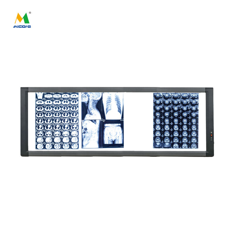 MICARE Quatra/MG-4C 100w Stabilizované lekárske pozorovacie svetlo Prehliadač röntgenových filmov