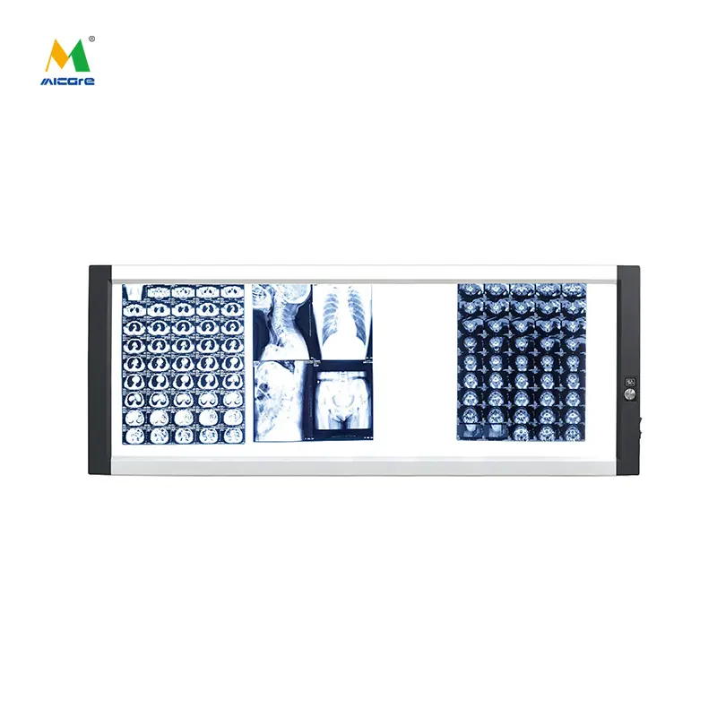 Why Edge-to-Edge Uniformity Is Critical in Digital X-Ray Display