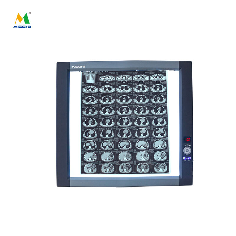 MICARE Single(ZG-1C) Medical Film Viewer Brightness Top sale single side X-ray Film Viewer