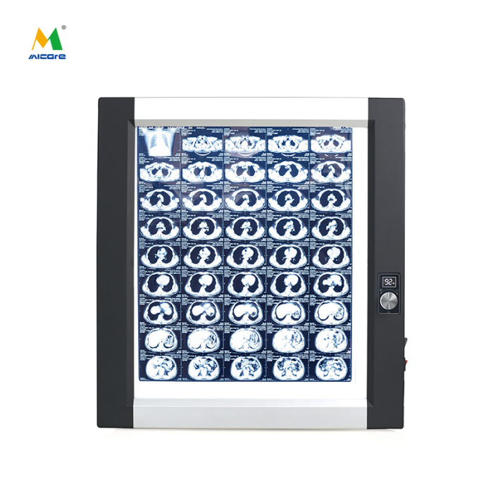 Kāpēc ķirurgiem filma skatīšanai nepieciešama vienmērīga aizmugurējā apgaismojuma