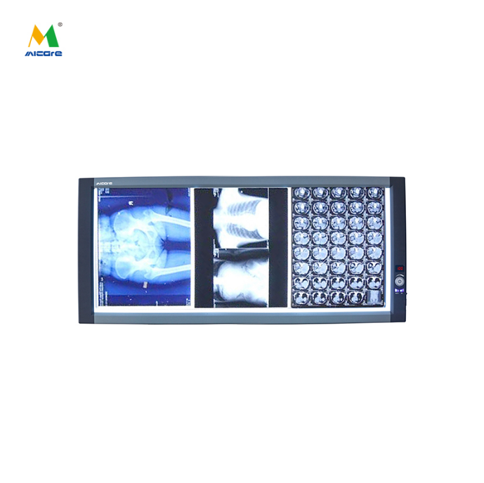 Selecting X-Ray View Boxes for Radiology Departments