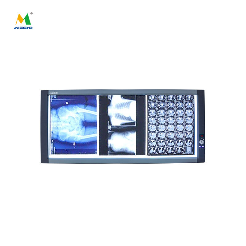 MICARE Triple(ZG-3C) LED X-ray viewer, negative mirror, medical movie viewer multi-screen