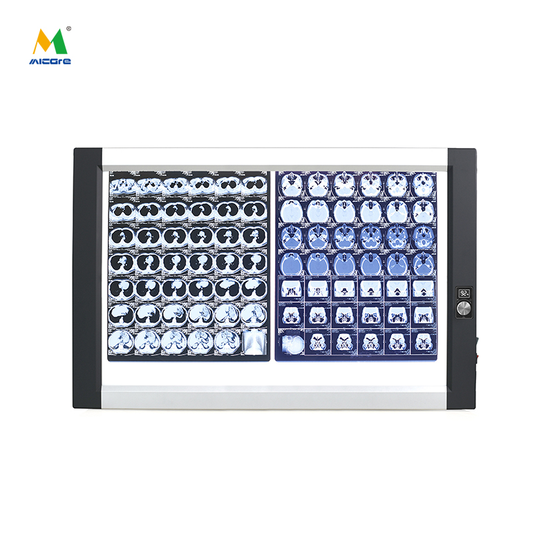 LED X-ray Viewers: Modern Medical Light Boxes for Precise Diagnostics