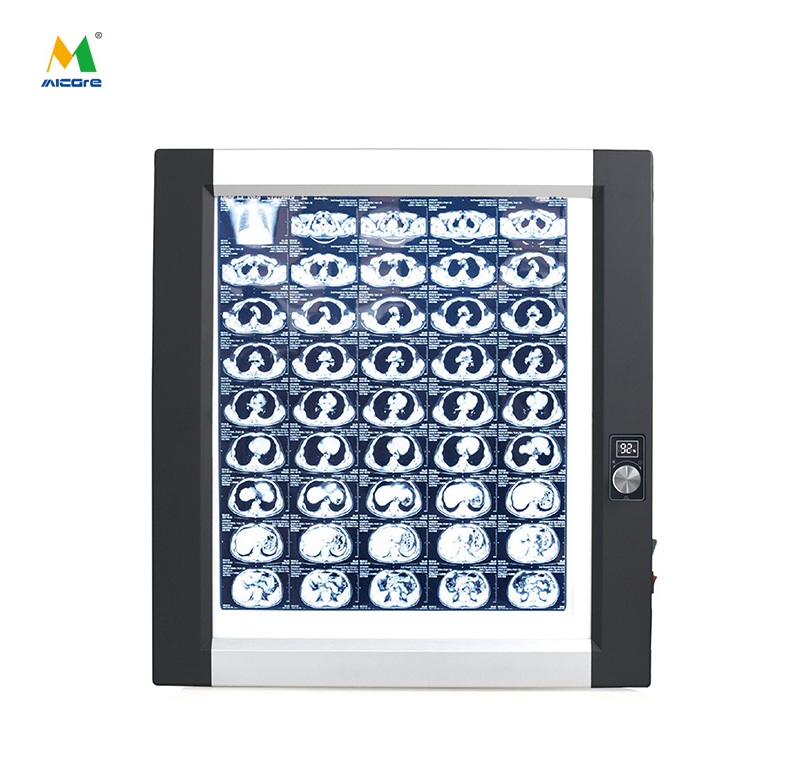 What Specifications Matter Most in Medical Grade X-Ray View Boxes? 