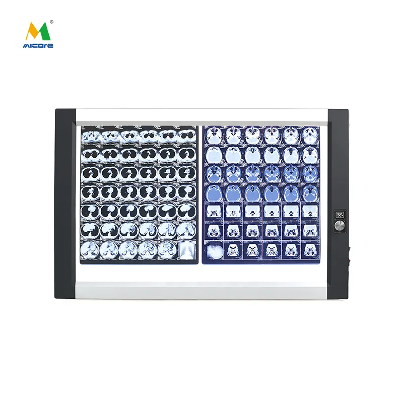 Co wpływa na wyrazistość obrazu przy przeglądaniu filmów medycznych