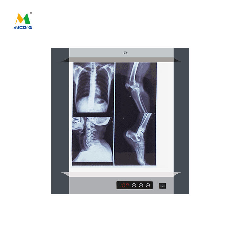 Micare MG Single link viewing light LCD SUPER THIN X-RAY ILLUMINATOR X-ray film viewers for hospitals, clinics, colleges and institutes