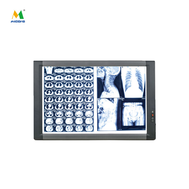 MICARE Double/MG-2C LED-visningsboks, røntgenfremviser, Negatoskop, medicinsk filmfremviser dobbeltskærm