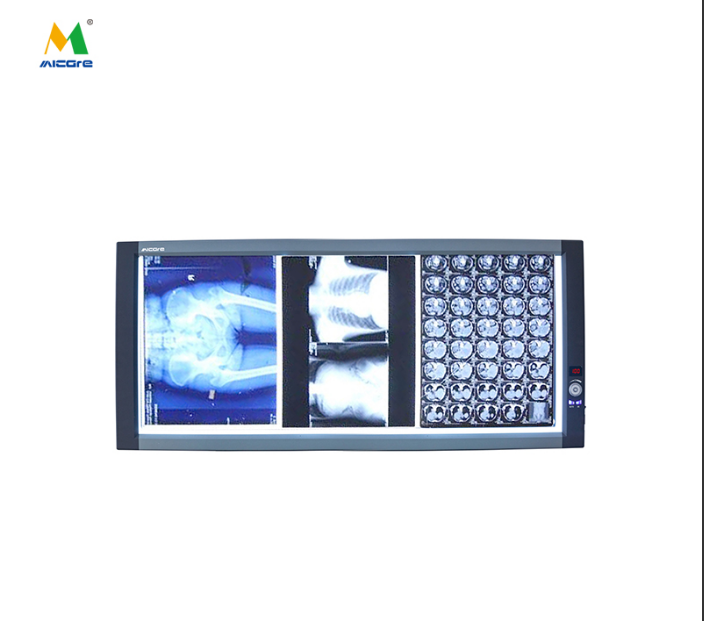What Distinguishes Diagnostic-Grade from Basic Medical X-Ray Viewers