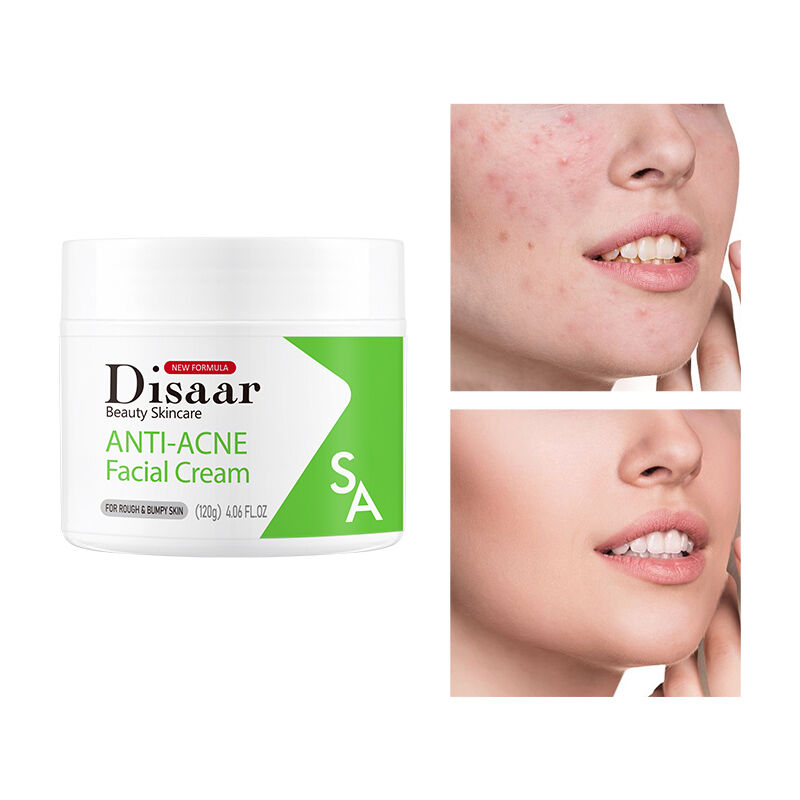 Image showcasing Anti Acne Salicylic Acid Facial Cream Anti Inflammatory Whitening Fade ...