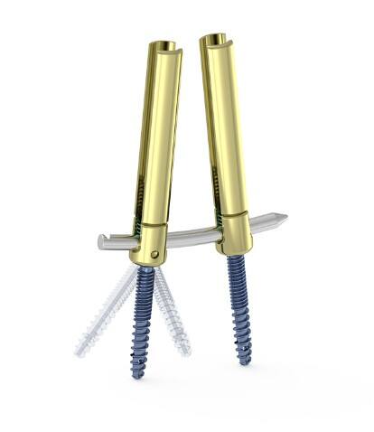 Top 10 Orthopedic Bone Screws for Spinal Surgery