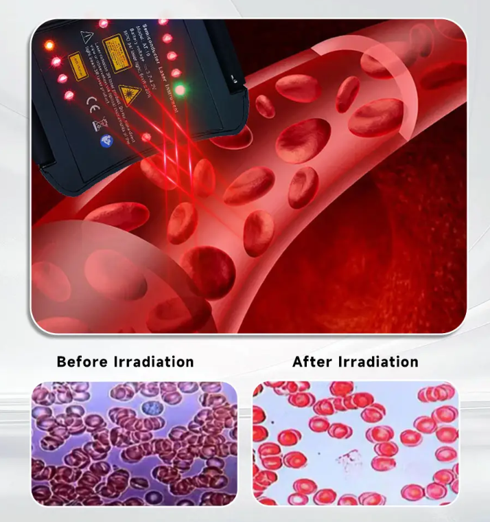 Cómo reducir la presión arterial de forma natural en casa?