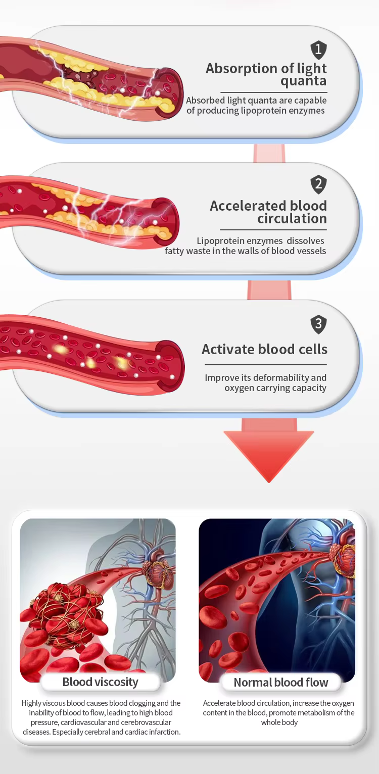 Atherosclerosis cvd Red Light Therapy for Transient Ischemic Attack (TIA) Symptoms Home Care Laser Therapy Watch for Stroke Symptom Relief & Prevention supplier