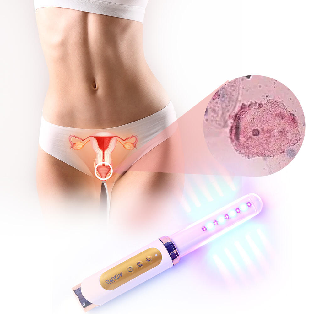 Yoni Product Vagina Yeast Infection Therapy Cold Laser For Vaginitis Cervical Erosion Light Therapy Device Urinary Incontinence
