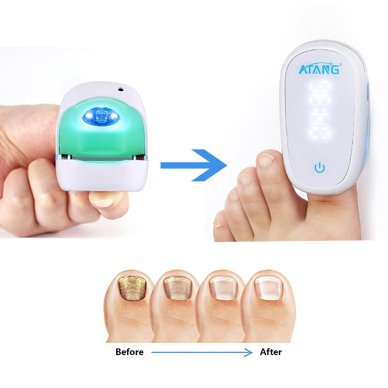 Gray Nail Treatment Instrument