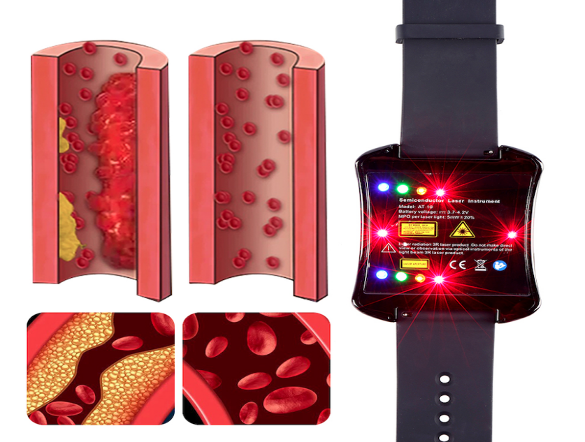 Jak snížit hladinu cholesterolu přirozeně pomocí inovativních zdravotních zařízení