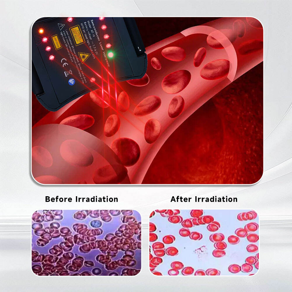 Type 2 Diabetes Symptoms LLLT Therapy For Coronary Arterial Lower Blood Pressure Naturally Laser Watch Physiotherapy