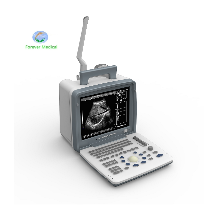 The Importance of Choosing the Right 3D Ultrasound Machine for Your Needs