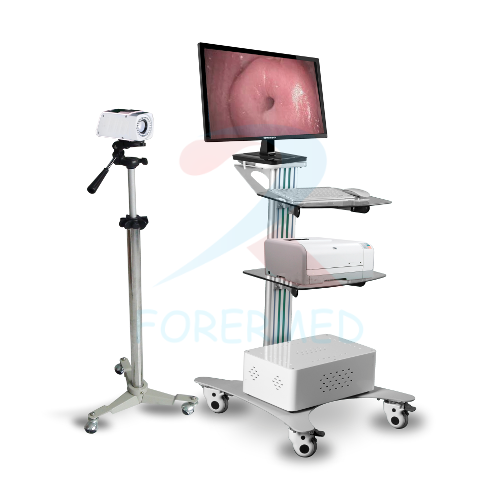 Digital Electronic Colposcope