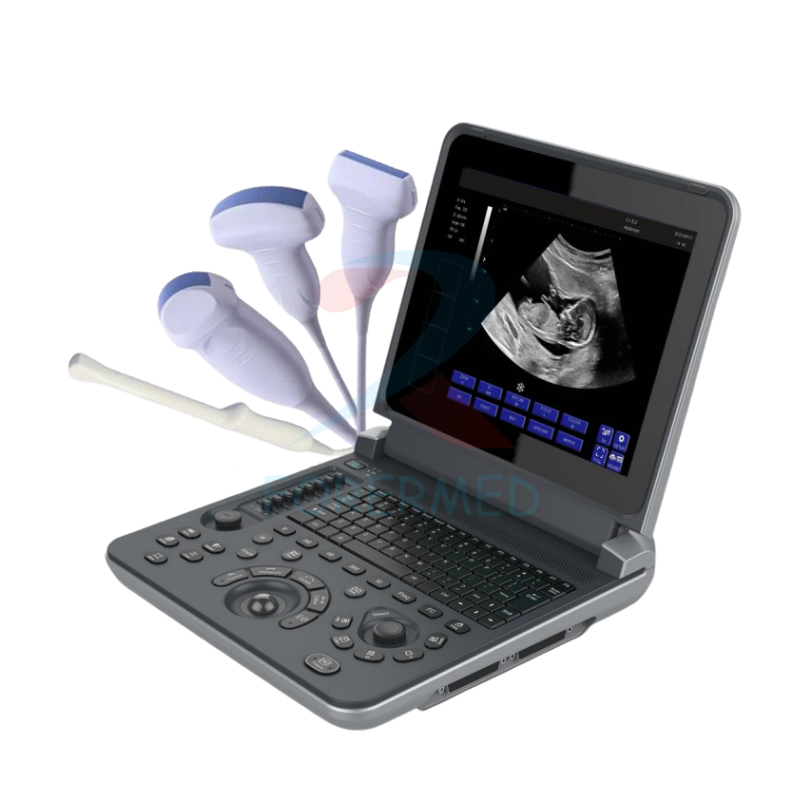 Portable Diagnostic Ultrasound Machina