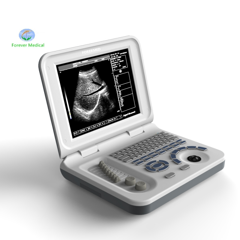 Ultrasound Scan Pregnancy YJ-X30