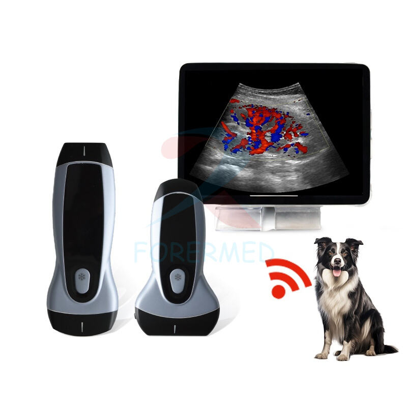 Wireless Color Doppler Ultrasound 