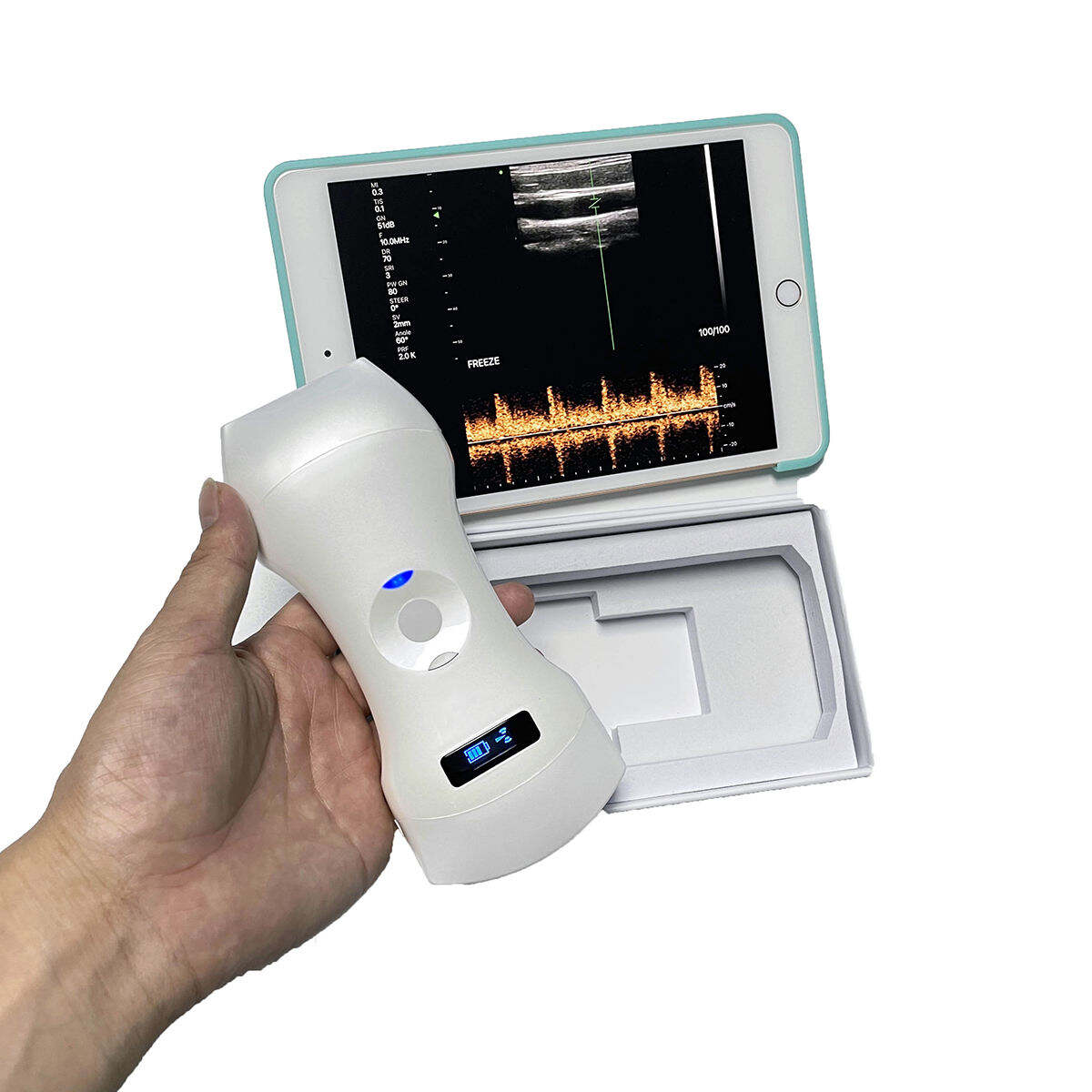 Portable Wifi Ultrasound