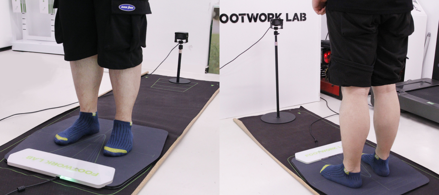 Сканиране на ходенето с помощта на изкуствен интелект: Първият избор за всеобхватна оценка на здравето на стъпалата